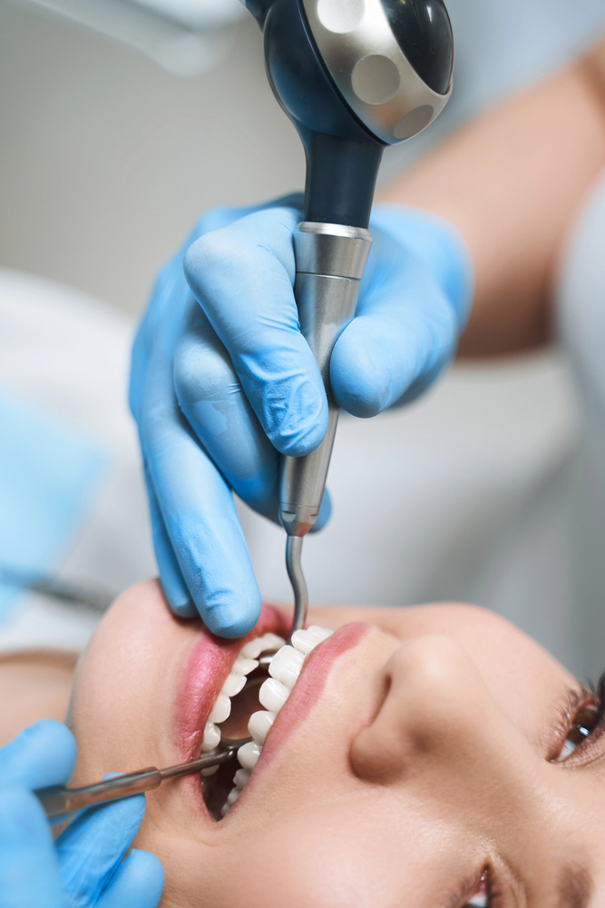 Dental Fillings