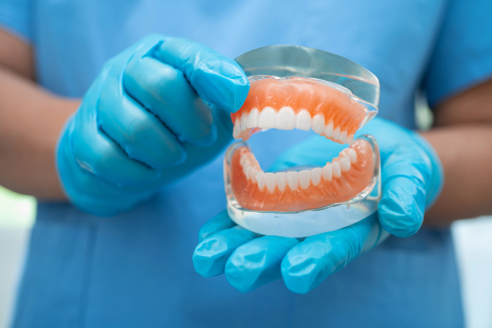 Partial Dentures