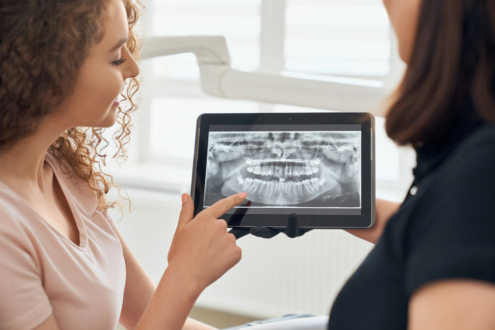 Post-Treatment Care for Tooth Removals